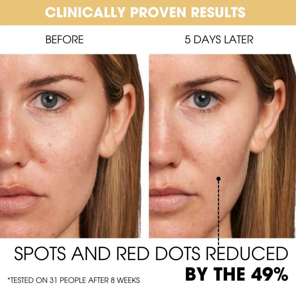 ADVANCED KOREAN ENCAPSULATED VITAMIN C TECHNOLOGY FOR BRIGHTER, MORE EVEN-LOOKING SKIN